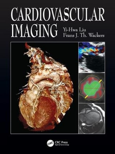 Cardiovascular Imaging by Yi-Hwa Liu 9781840761917