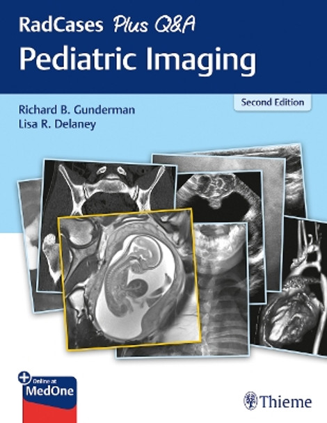 RadCases Plus Q&A Pediatric Imaging by Richard B. Gunderman 9781626235199