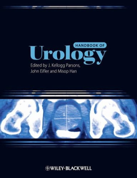 Handbook of Urology by J. Kellogg Parsons 9780470672563