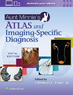 Aunt Minnie's Atlas and Imaging-Specific Diagnosis by Thomas L Pope Jr. 9781975181970