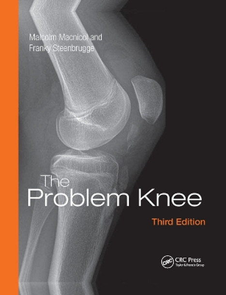 The Problem Knee by Malcolm Macnicol 9781138372467