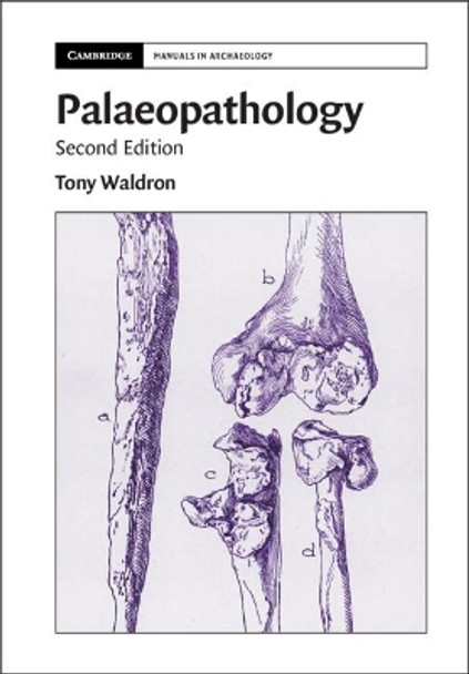 Palaeopathology by Tony Waldron 9781108730884