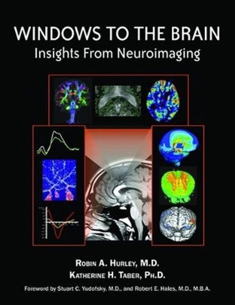 Windows to the Brain: Insights From Neuroimaging by Robin A. Hurley 9781585623020