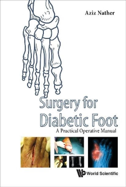 Surgery For Diabetic Foot: A Practical Operative Manual by Aziz Nather 9789814759830