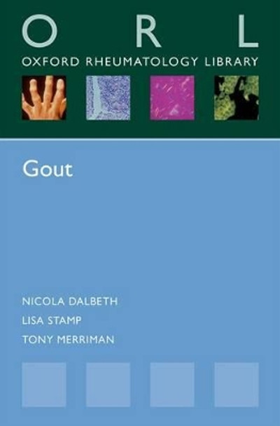 Gout by Nicola Dalbeth 9780198748311