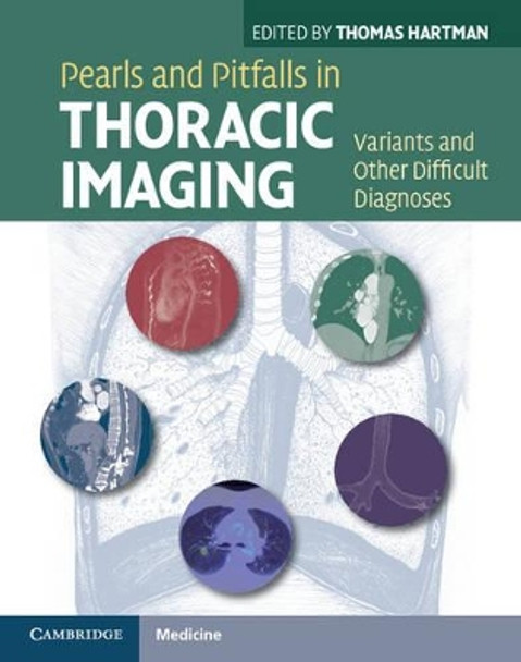 Pearls and Pitfalls in Thoracic Imaging: Variants and Other Difficult Diagnoses by Thomas Hartman 9780521119078