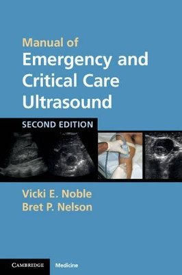 Manual of Emergency and Critical Care Ultrasound by Vicki E. Noble 9780521170918