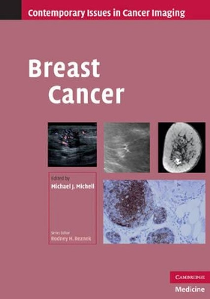 Breast Cancer by Michael J. Michell 9780521519502