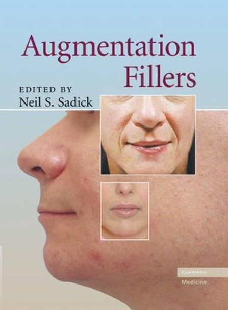 Augmentation Fillers by Neil S. Sadick 9780521881128