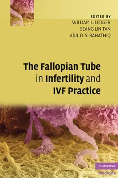 The Fallopian Tube in Infertility and IVF Practice by William L. Ledger 9780521873789