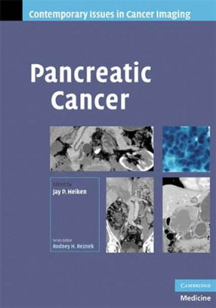 Pancreatic Cancer by Jay P. Heiken 9780521886925