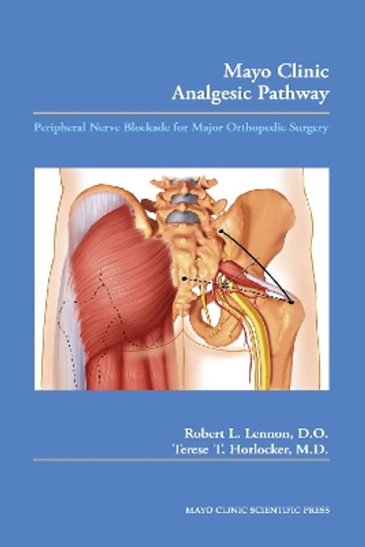 Mayo Clinic Analgesic Pathway: Peripheral Nerve Blockade for Major Orthopedic Surgery by Robert L. Lennon 9780849395727