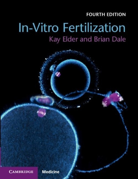 In-Vitro Fertilization by Kay Elder 9781108441810