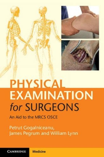 Physical Examination for Surgeons: An Aid to the MRCS OSCE by Petrut Gogalniceanu 9781107625549