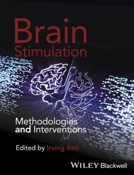 Brain Stimulation: Methodologies and Interventions by Irving Reti 9781118568293