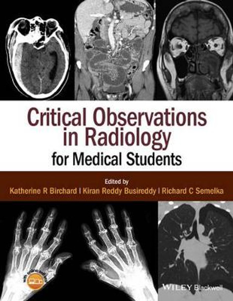 Critical Observations in Radiology for Medical Students by Richard C. Semelka 9781118904718