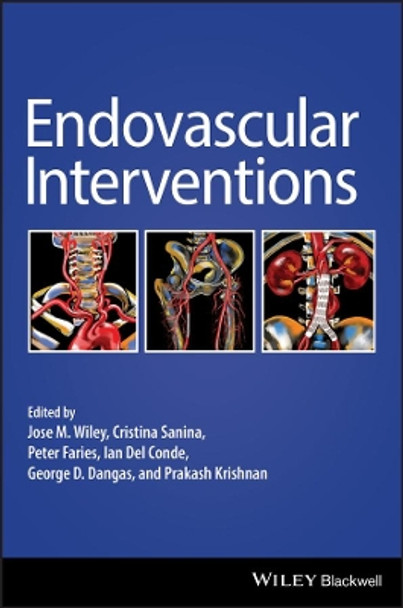 Endovascular Interventions by Jose M. Wiley 9781119283492