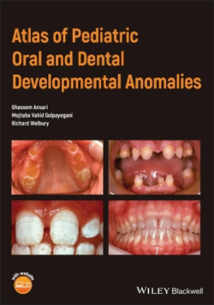 Atlas of Pediatric Oral and Dental Developmental Anomalies by Ghassem Ansari 9781119380856