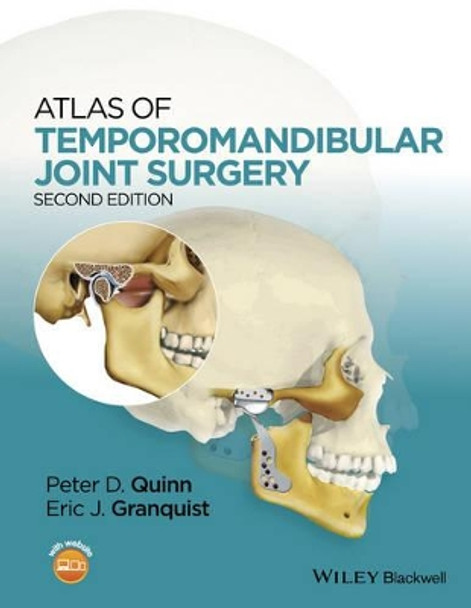 Atlas of Temporomandibular Joint Surgery by Peter D. Quinn 9781119949855