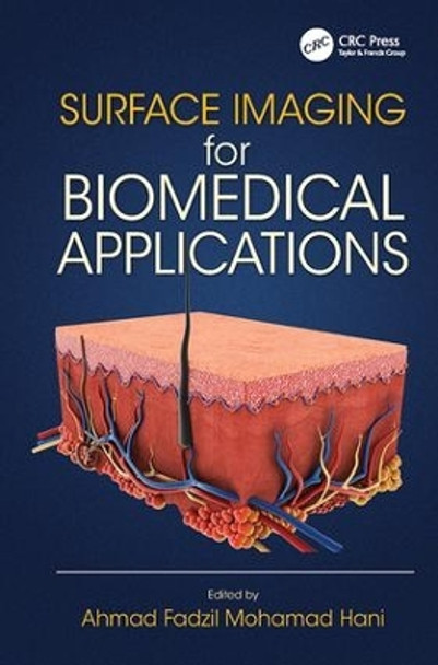 Surface Imaging for Biomedical Applications by Ahmad Fadzil Mohamad Hani 9781138075665