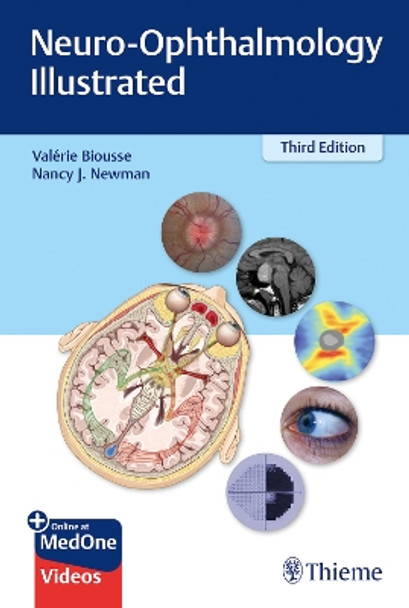 Neuro-Ophthalmology Illustrated by Valerie Biousse 9781684200740