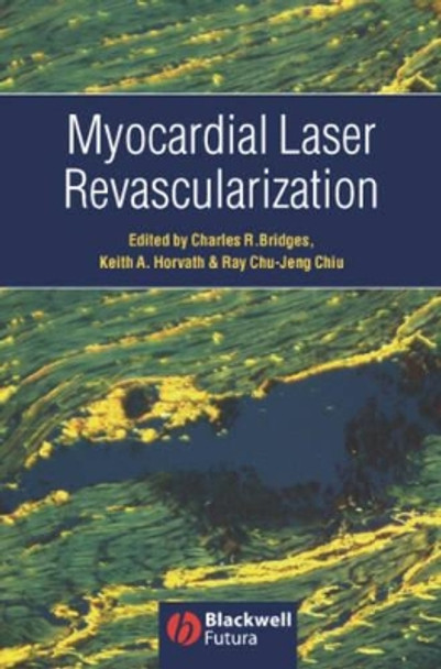 Myocardial Laser Revascularization by Charles Bridges 9781405122108