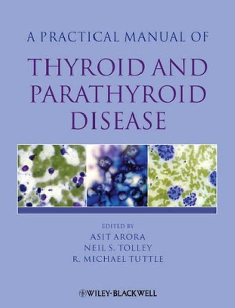 Practical Manual of Thyroid and Parathyroid Disease by Asit Arora 9781405170345