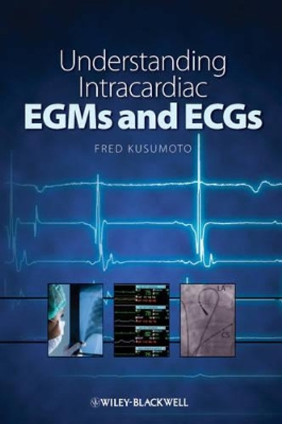 Understanding Intracardiac EGMs and ECGs by Fred M. Kusumoto 9781405184106
