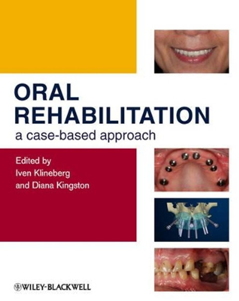 Oral Rehabilitation: A Case-Based Approach by Iven Klineberg 9781405197816