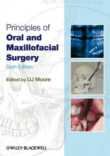 Principles of Oral and Maxillofacial Surgery by U. J. Moore 9781405199988