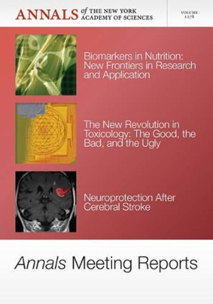 Annals Meeting Reports - G Protein-Coupled Receptors, Complex Drugs and Regulatory Guidance, Fetal Programming and Environmental Exposures, Volume 1276 by Douglas Braaten 9781573318938