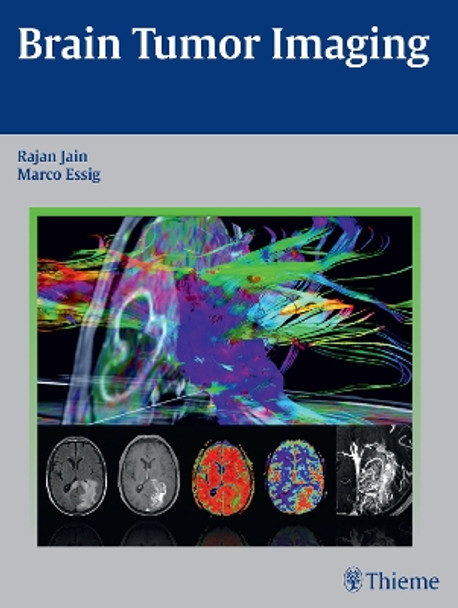 Brain Tumor Imaging by Rajan Jain 9781604068061