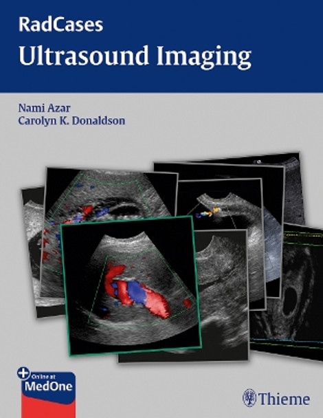 Radcases Ultrasound Imaging by Nami R. Azar 9781604063226