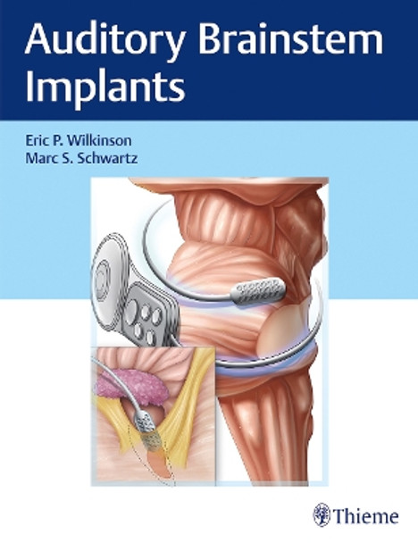 Auditory Brainstem Implants by Eric Wilkinson 9781626238268