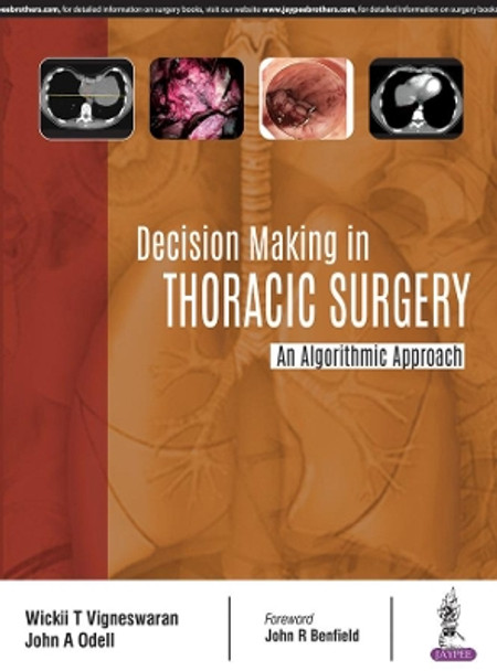 Decision Making in Thoracic Surgery: An Algorithmic Approach by Wickii T Vigneswaran 9789352700387