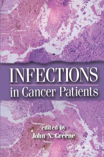 Infections in Cancer Patients by John N. Greene 9780367394295