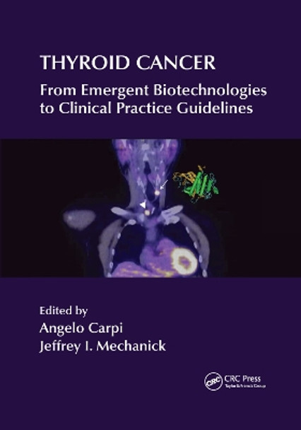 Thyroid Cancer: From Emergent Biotechnologies to Clinical Practice Guidelines by Angelo Carpi 9780367382711