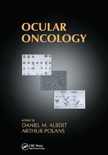 Ocular Oncology by Daniel M. Albert 9780367446673