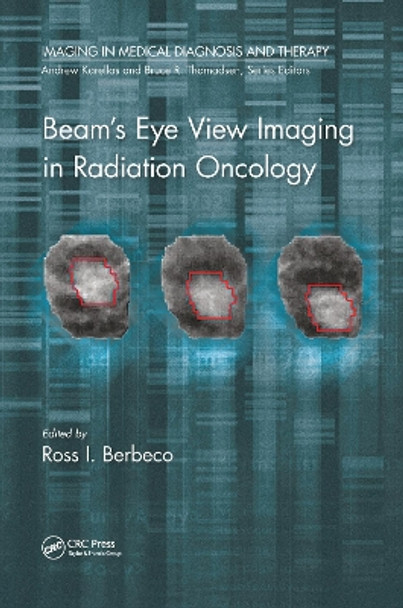 Beam's Eye View Imaging in Radiation Oncology by Ph.D. Berbeco 9780367781934