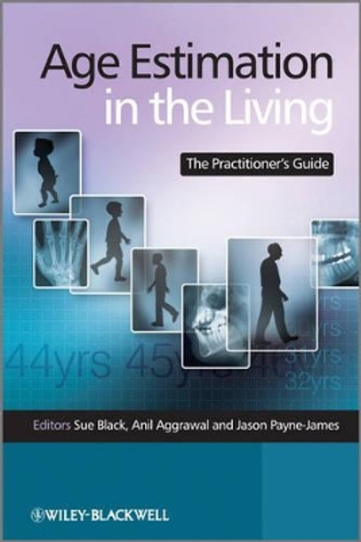 Age Estimation in the Living: The Practitioner's Guide by Sue Black 9780470519677