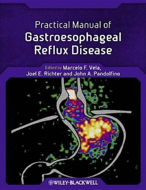 Practical Manual of Gastroesophageal Reflux Disease by Marcelo F. Vela 9780470656266