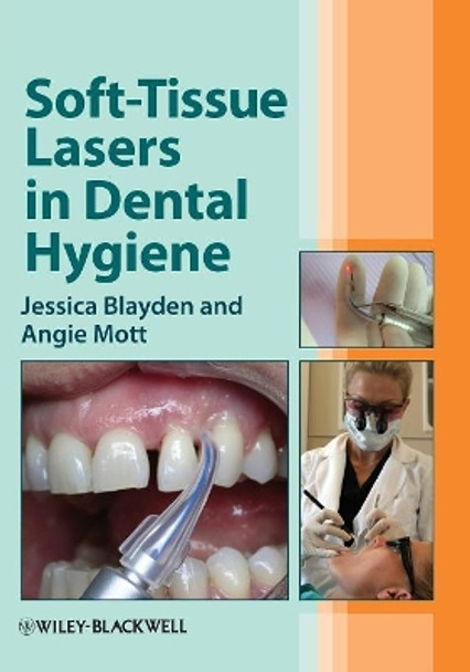 Soft-Tissue Lasers in Dental Hygiene by Jessica Blayden 9780470958544