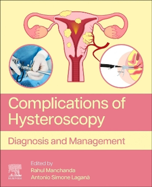 Complications of Hysteroscopy: Diagnosis and Management by Rahul Manchanda 9780443216169