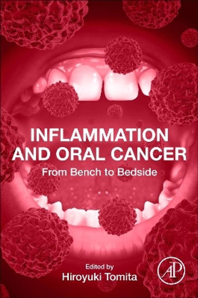 Inflammation and Oral Cancer: From Bench to Bedside by Hiroyuki Tomita 9780323885263