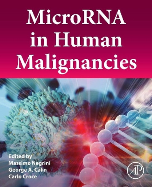 MicroRNA in Human Malignancies by Massimo Negrini 9780128222874