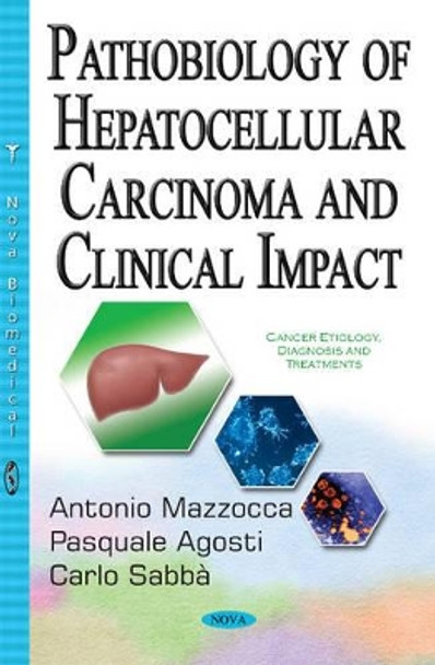 Pathobiology of Hepatocellular Carcinoma & Clinical Impact by Antonio Mazzocca 9781536100020