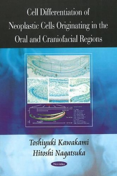 Cell Differentiation of Neoplastic Cells Originating in the Oral & Craniofacial Regions by Toshiyuki Kawakami 9781604569322