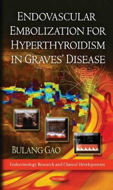 Endovascular Embolization for Hyperthyroidism in Graves' Disease by Bulang Gao 9781611229721