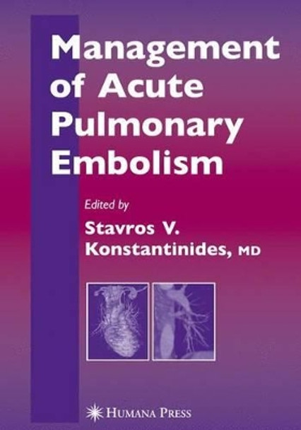 Management of Acute Pulmonary Embolism by Stavros Konstantinides 9781617376924