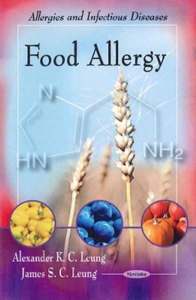 Food Allergy by Alexander K. C. Leung 9781617289521